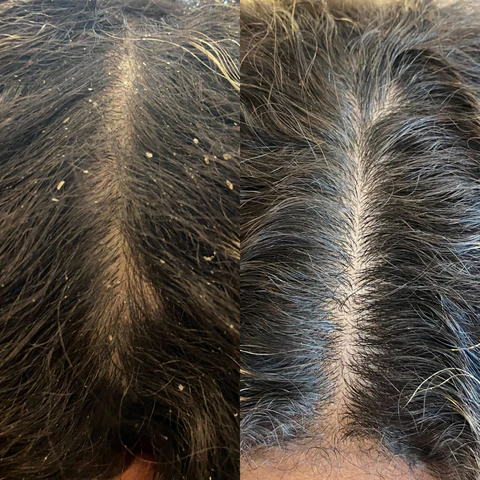 Hair Relaxer Without Lye: The Gentle Way to Straighten Curly, Textured Hair